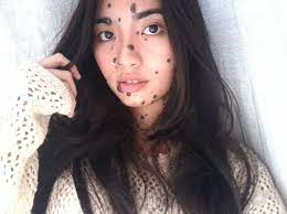 Woman bullied for head-to-toe moles could be crowned the next Miss Universe  | The Independent | The Independent