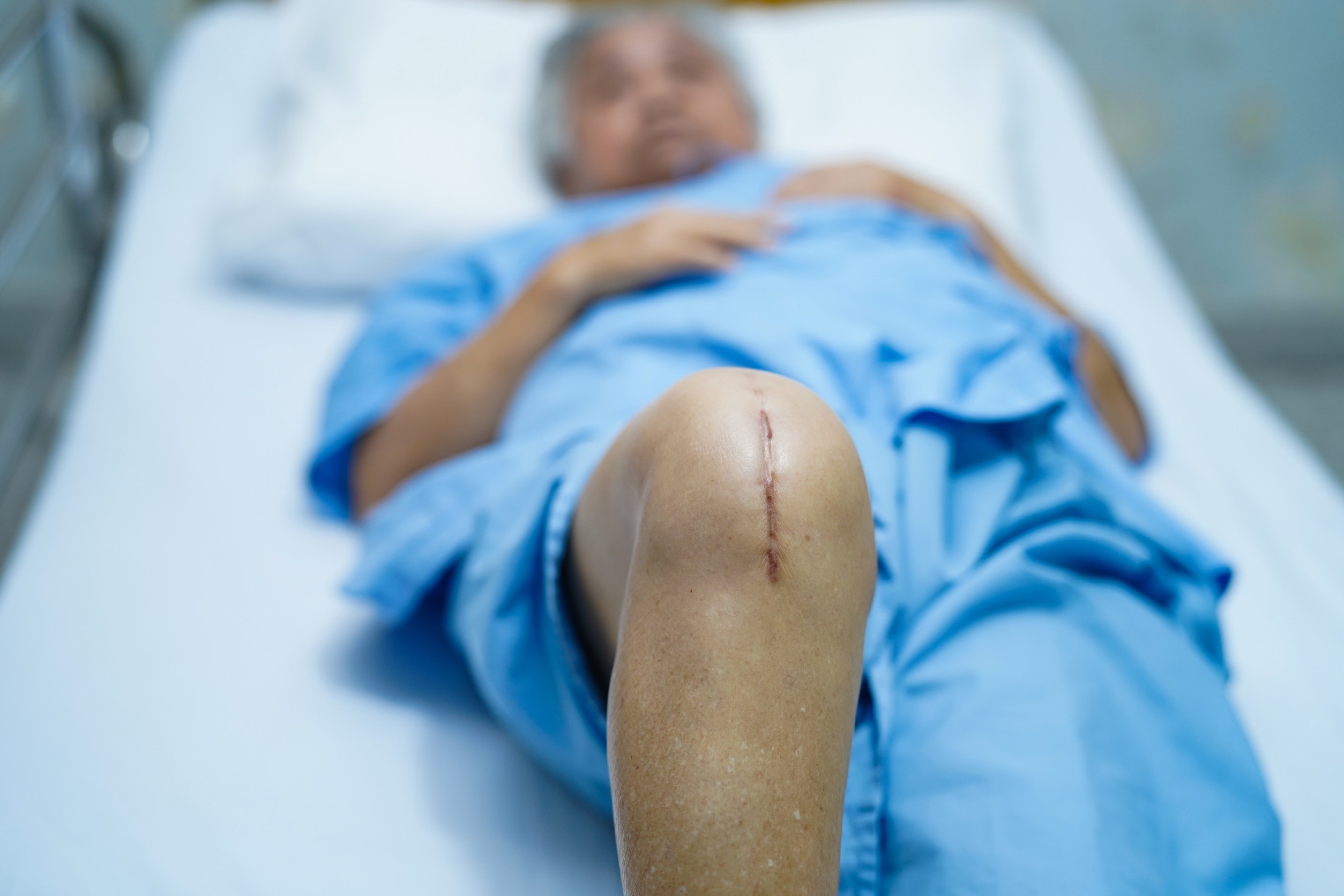 A man lays in a hospital bed with a scar on his knee