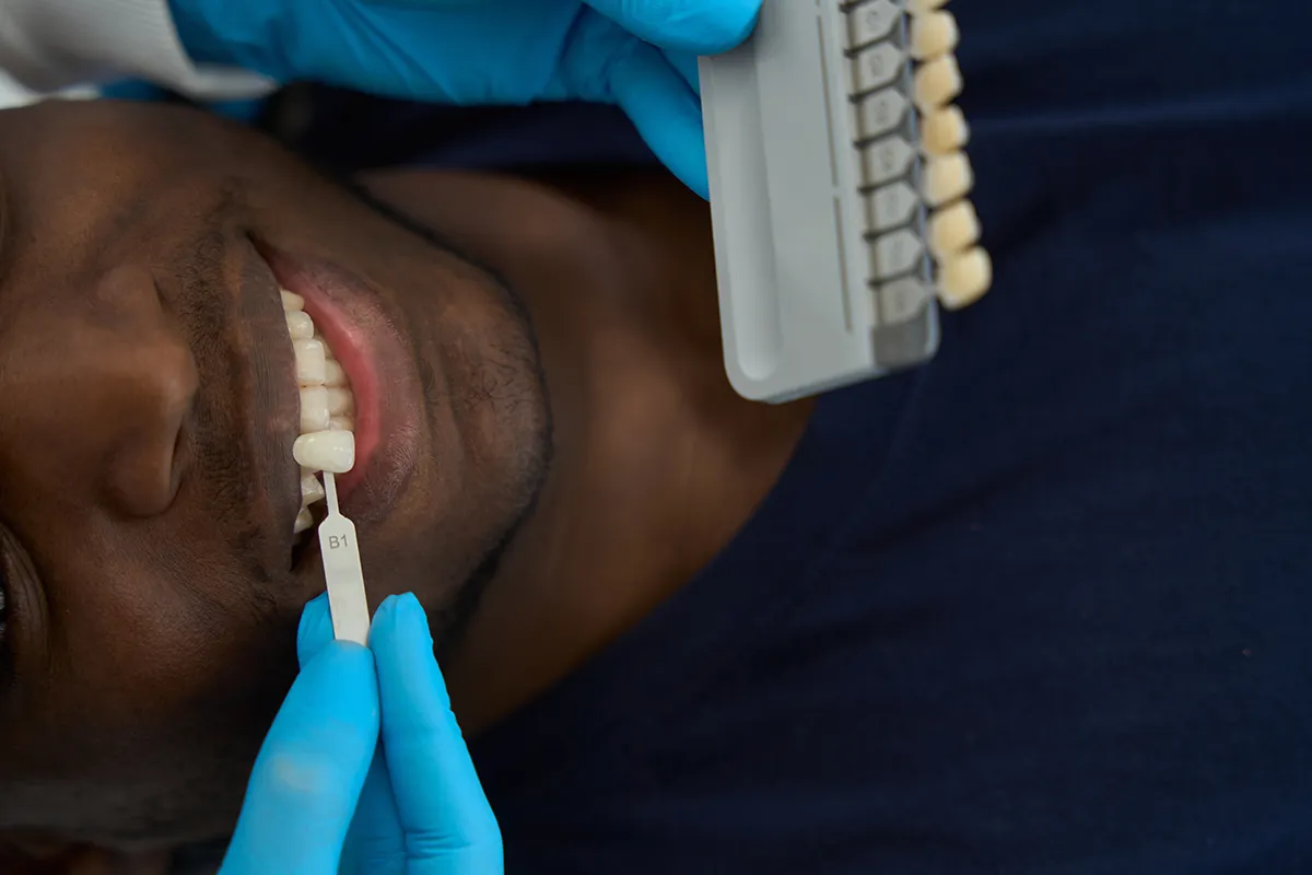 Dental patient smiling during tooth shade matching procedure, with dentist using blue gloves to hold shade guide marked "B1" while comparing to natural teeth. Retry
