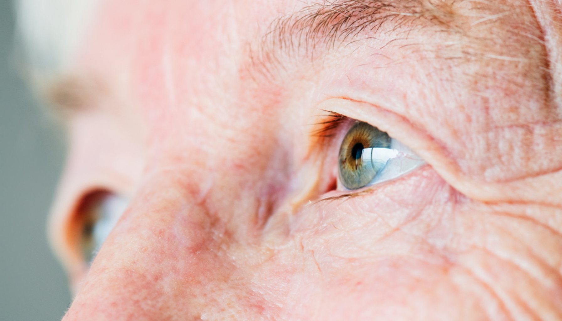 Nærbilde av eldre persons øyne med synlige rynker og detaljer i hud og iris. grønn stær grønn stær glaukom behandling av grønn stær trykket i øyet trykket inne i øyet stær inne i øyet redusere trykket i øyet grønn trykk i øyet grønn stær kan oppstå høyt trykk grønn stær i familien finnes god behandling utvikle grønn stær skade på synsnerven trykket i øynene føre til blindhet redusere trykket grå stær glaukom hos personer akutt glaukom ene øyet norges blindeforbund høyt øyetrykk riktig behandling høy alder øyet 60 år høyt blodtrykk lang tid kronisk sykdom forhøyet trykk skader synsnerven økt risiko sist oppdatert senke øyetrykket behandling 40 år øyedråper operasjon synsnerven symptomer høyt hos sykdommen synet ofte andre tid vanligvis synsfeltet øyetrykk glaucoma behandlingen bør øynene flere dersom øyetrykket personer blindhet får tilstanden gir sykdom øyelege gradvis syn finnes ulike laserbehandling viktig skader kronisk behandles skade kirurgi laser årsaker