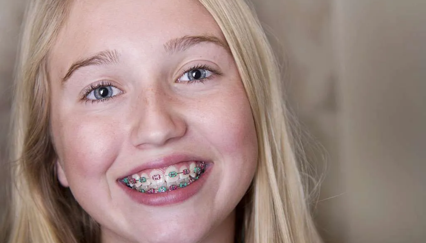 Tannregulering Alder – Hvilken alder er best?