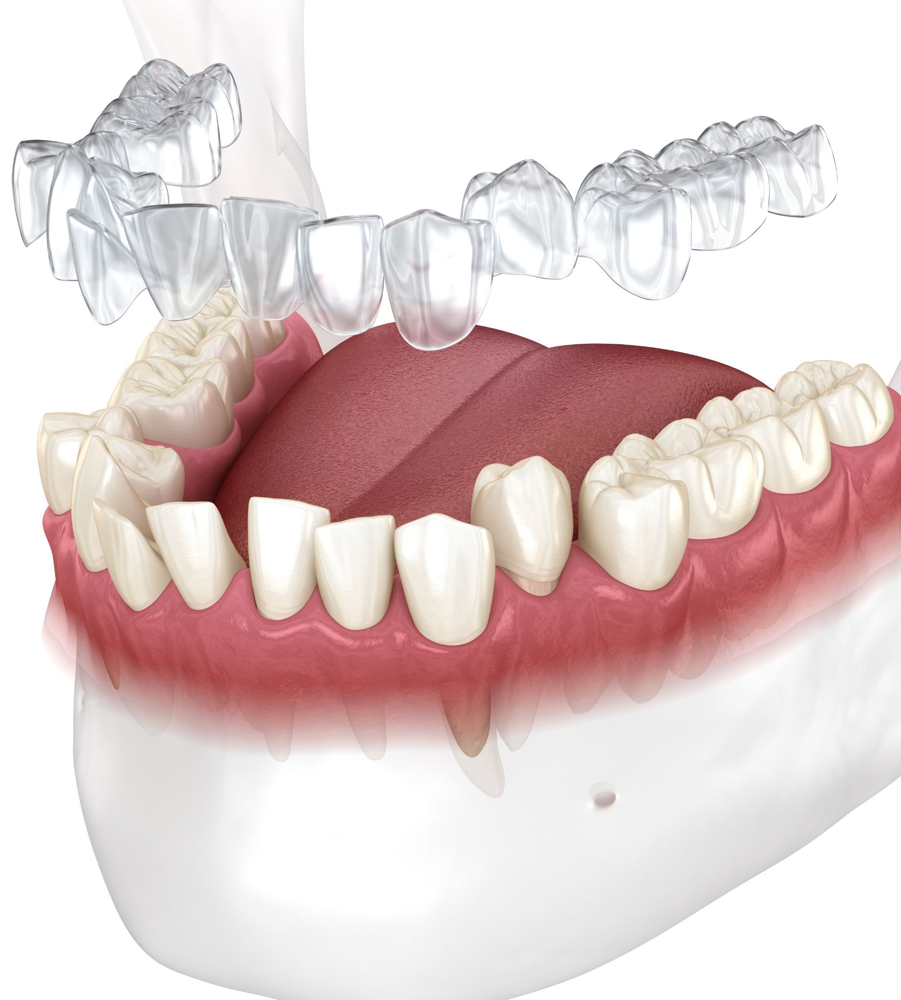 e411d18b 11a3 462a 9a91 52030b74eb63