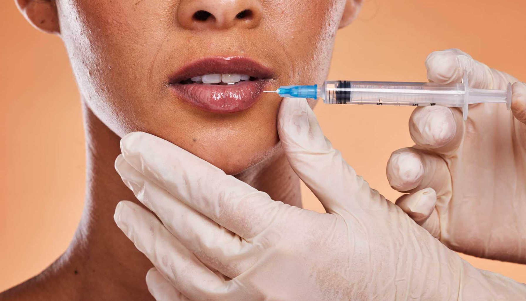 "Nærbilde av lepper der en sprøyte injiseres i underleppen, holdt av hender med medisinske hansker."