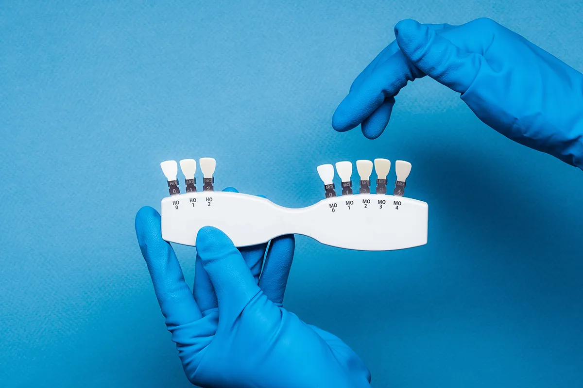 This image shows hands in blue gloves holding a dental shade guide against a blue background. The dentists is matching tooth colors for dental restorations.