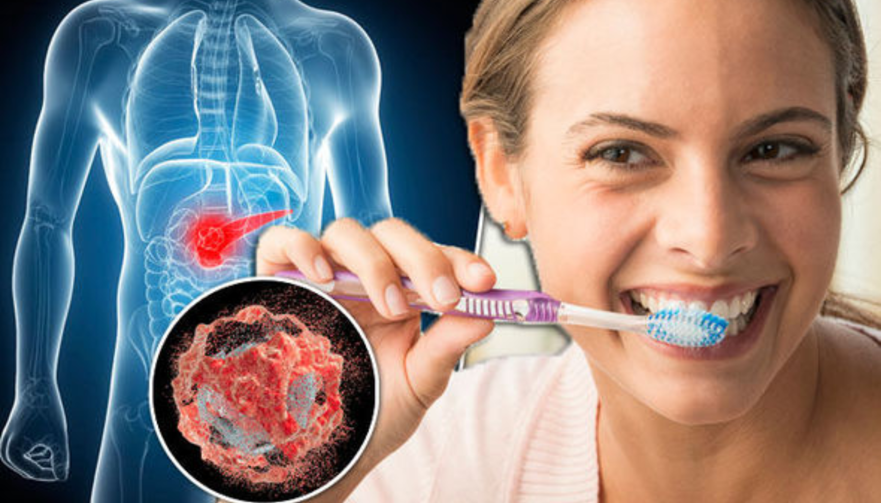 Kvinne pusser tennene, kombinert med medisinsk illustrasjon av bukspyttkjertelkreft og nærbilde av kreftcelle. acute pancreatitis of acute pancreatitis based guidelines for the evidence based guidelines management of of the classification of international consensus 3 ganger pancreatitis pancreas pasienten and ercp utredning endoskopisk mistanke første kirurgi eksokrin årsak fase etiologi fleste eksempel oppfølging tidlig vurderes gjøres pasientene behov diagnostikk kontroll multiorgansvikt behandles respons medikamenter døgn høy utvikle mild