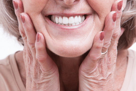 woman smiling showing off her dental implant dentures