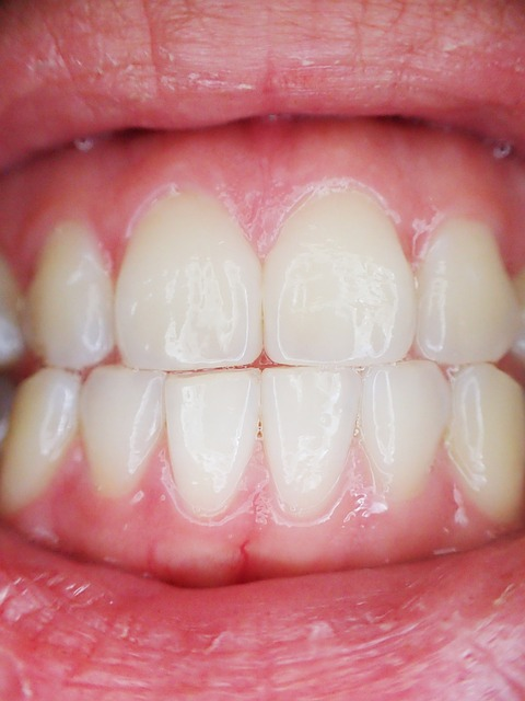 A closeup image of a persons lips, teeth, and gums. 