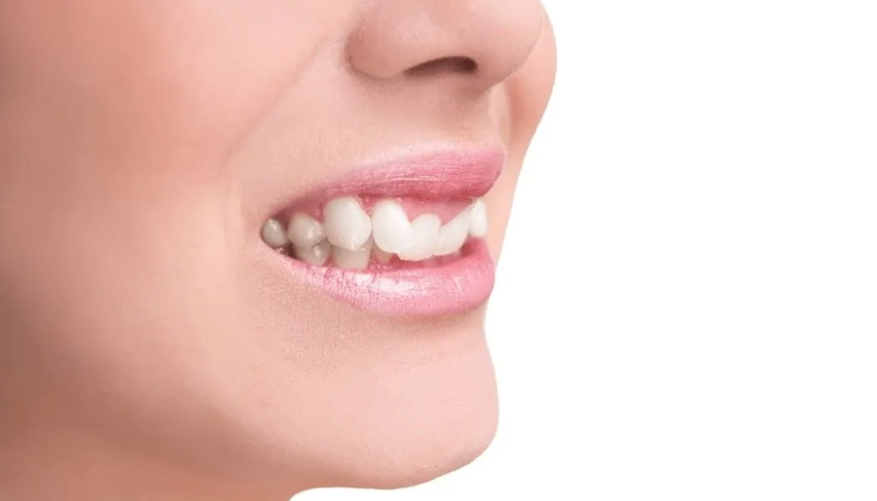 Nærbilde av smilende munn i sideprofil med synlige, rene tenner og naturlige lepper.
