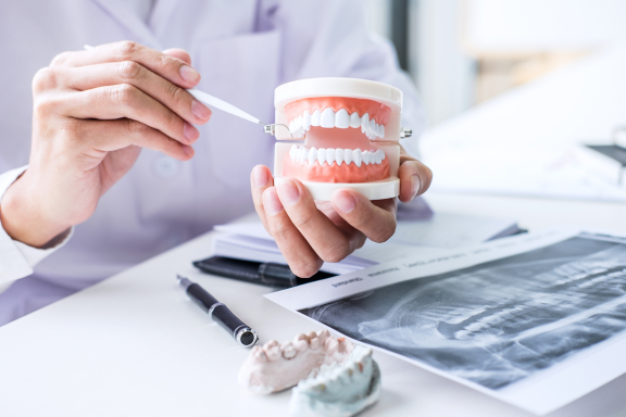 doctor points to an oral cavity on a jaw model
