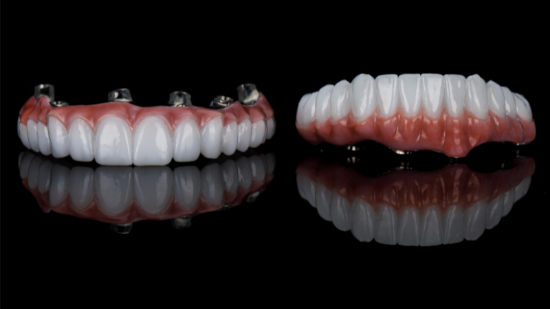 dental implants made of titaniu
