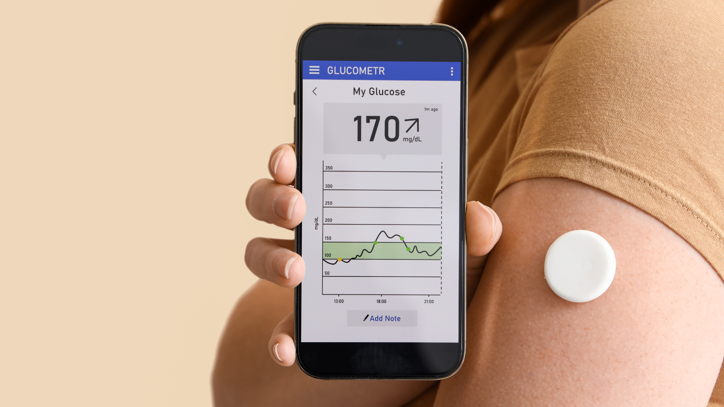 Blood glucose levels measuring app held by person with CGM device