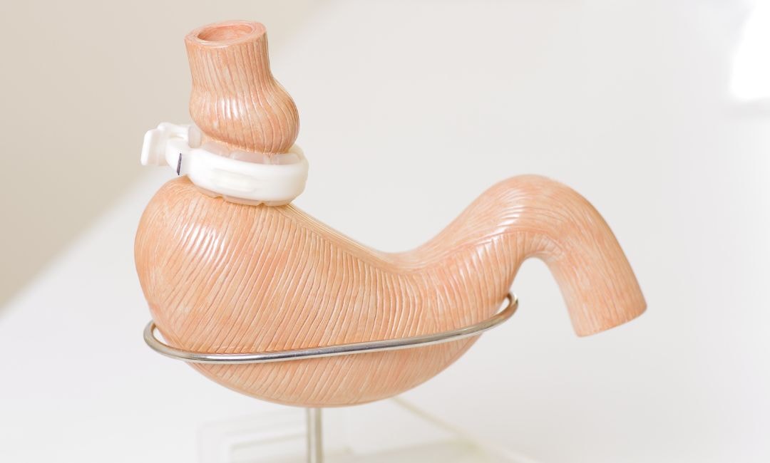 patients lose weight