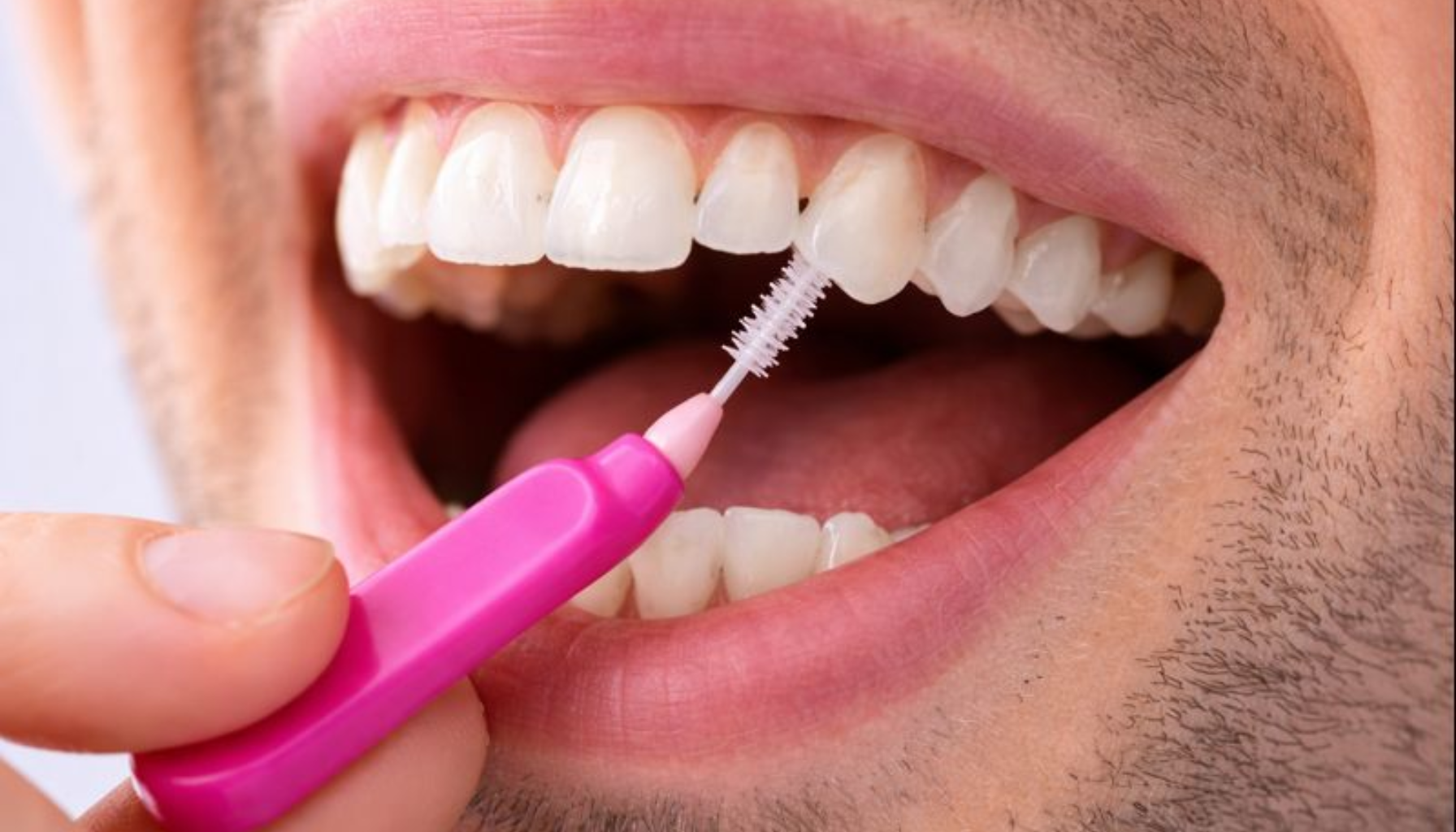 Mellomromsbørste: Det Beste Verktøyet for Renhold Mellom Tennene 14 En person bruker en liten mellomromsbørste for å rengjøre tennene nøye mellom tette tannrom.