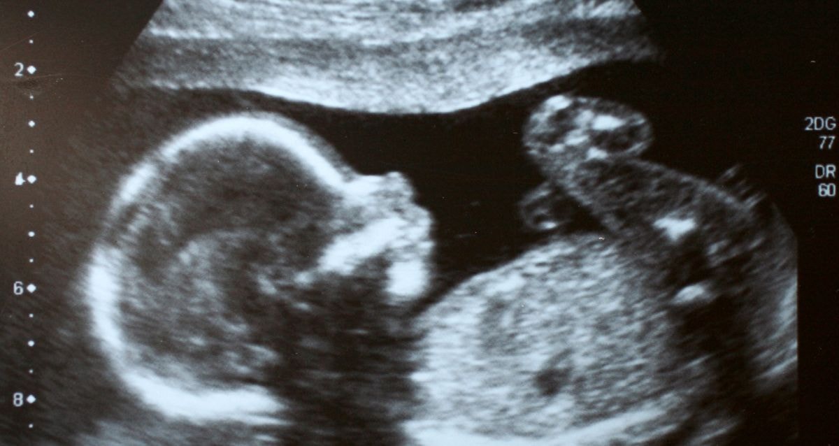 Many intended parents rely on egg donation