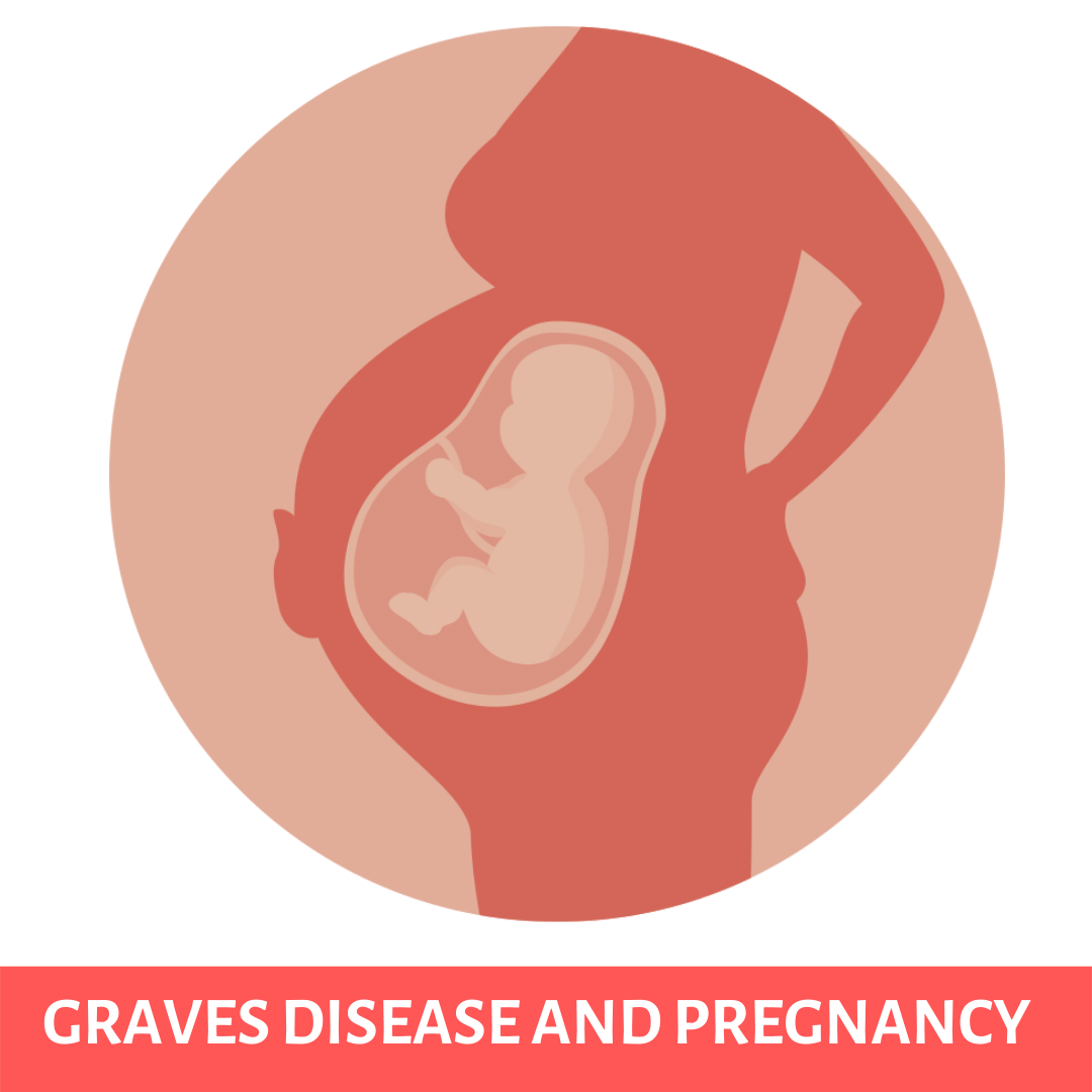 Graves disease and pregnancy My Endo Consult