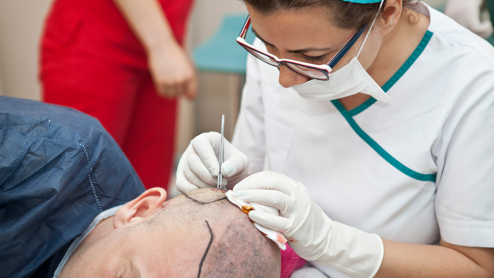 Benefits of a hair transplant
