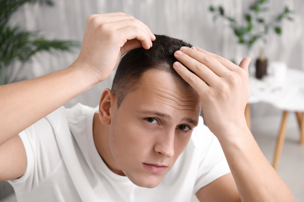 Everything you need to know about hair loss in your 20s
