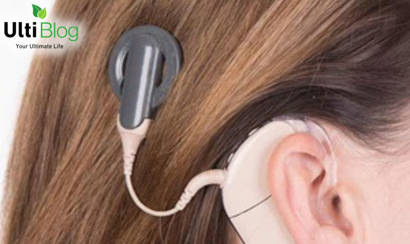 Cochlear implant in a post about The Latest Treatment For Hearing Loss