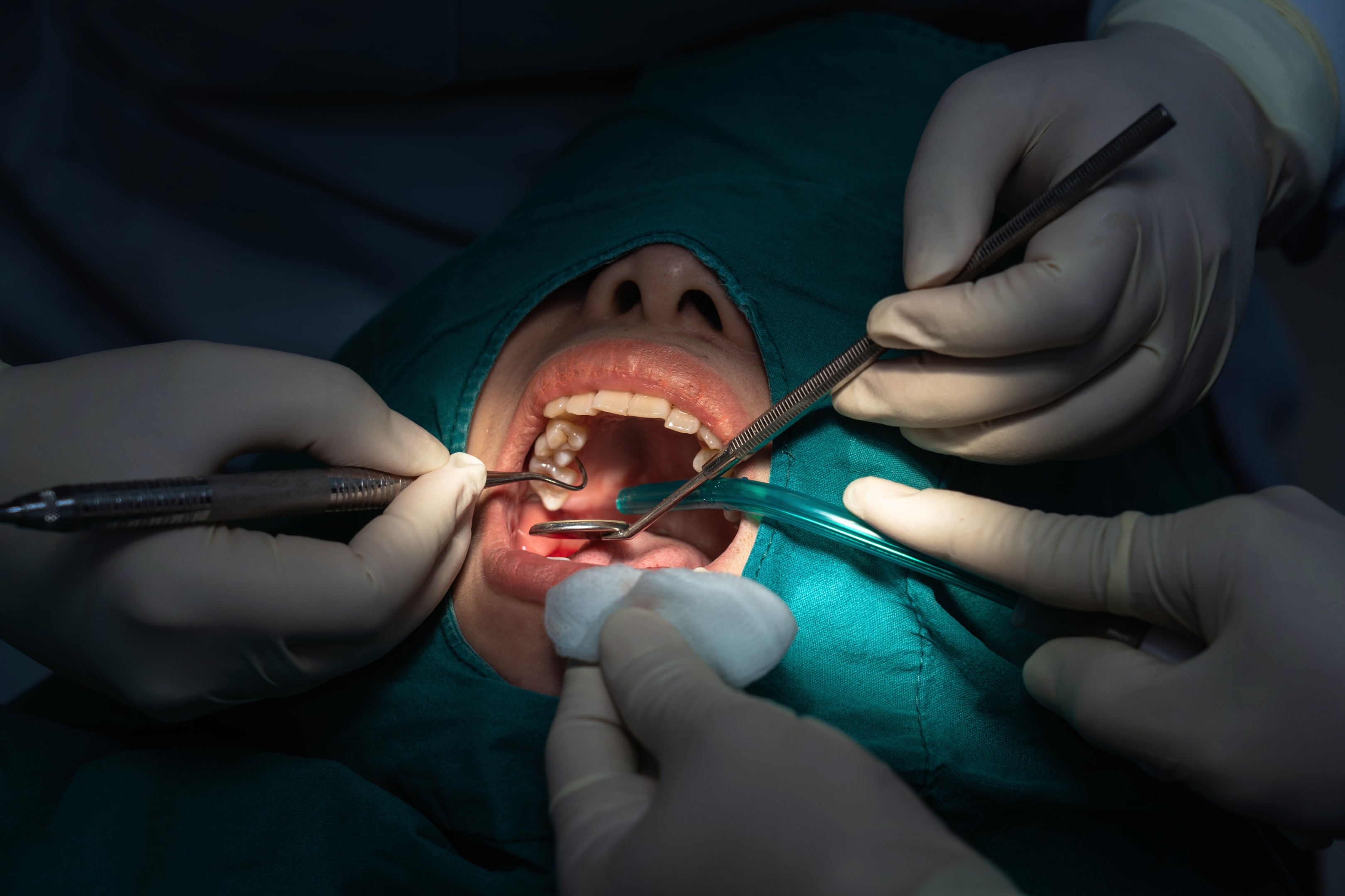 A photo of a patient having oral sedation.