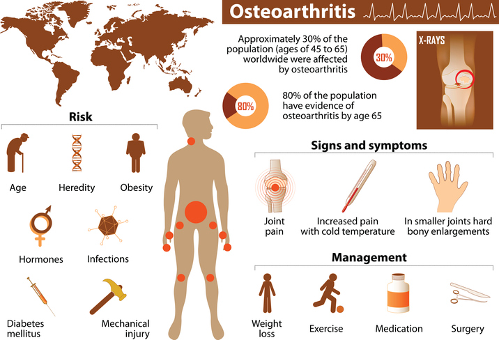 An infographic with graphical illustrations of rheumatoid arthritis statistics, risk factors, management, and complications with explanatory text described below.