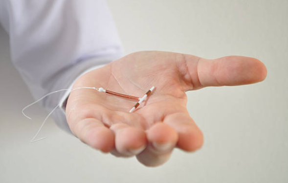 An intrauterine device, known as an intrauterine contraceptive device or coil, is a small, T-shaped device implanted into the uterus to prevent conception.