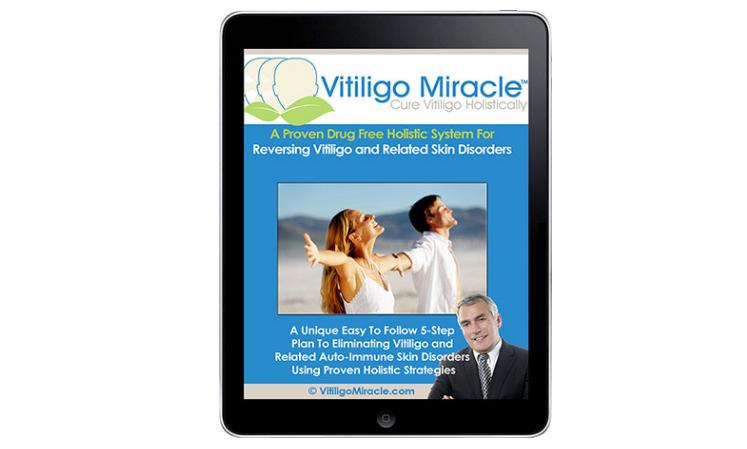 vitiligo miracle review