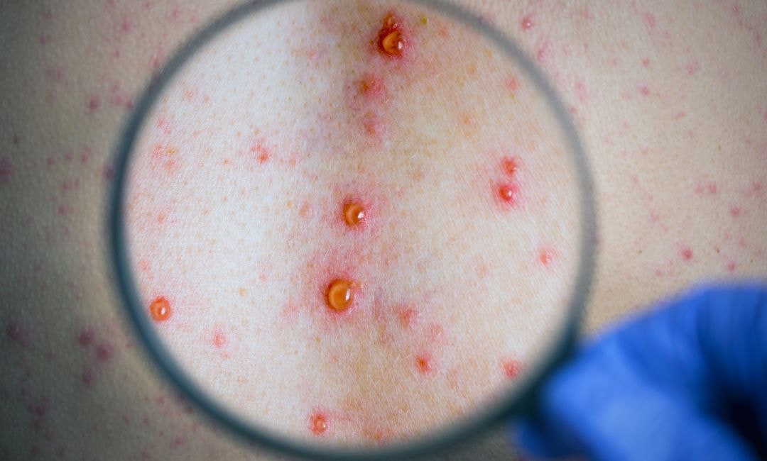 bpc-157 eczema BPC-157 Topical Cream main image 0