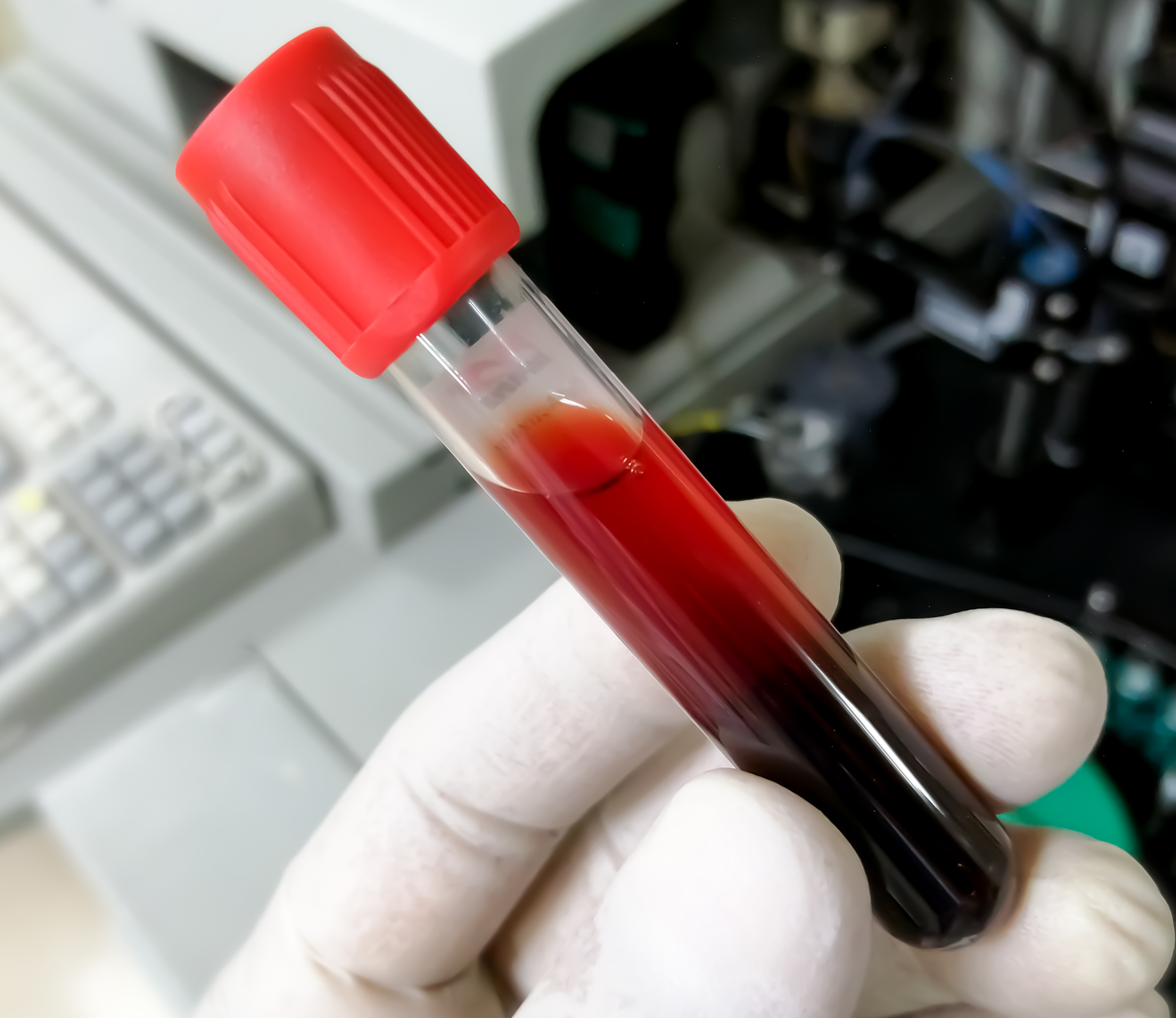 finger prick sample for blood collection 