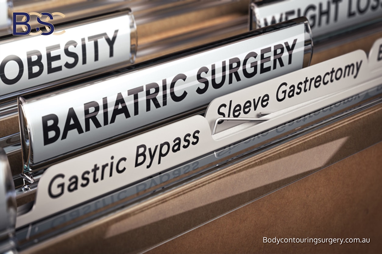 Nutrition and Bariatric Surgery Nutrition and Bariatric Surgery