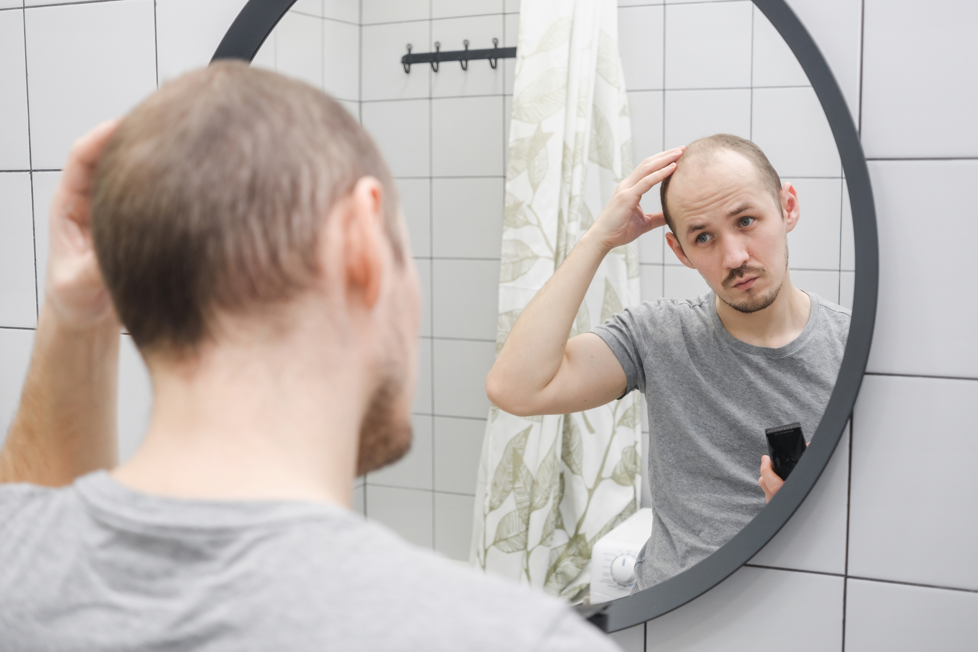 Thin hair at the hairline are a warning sign of receding hairline.