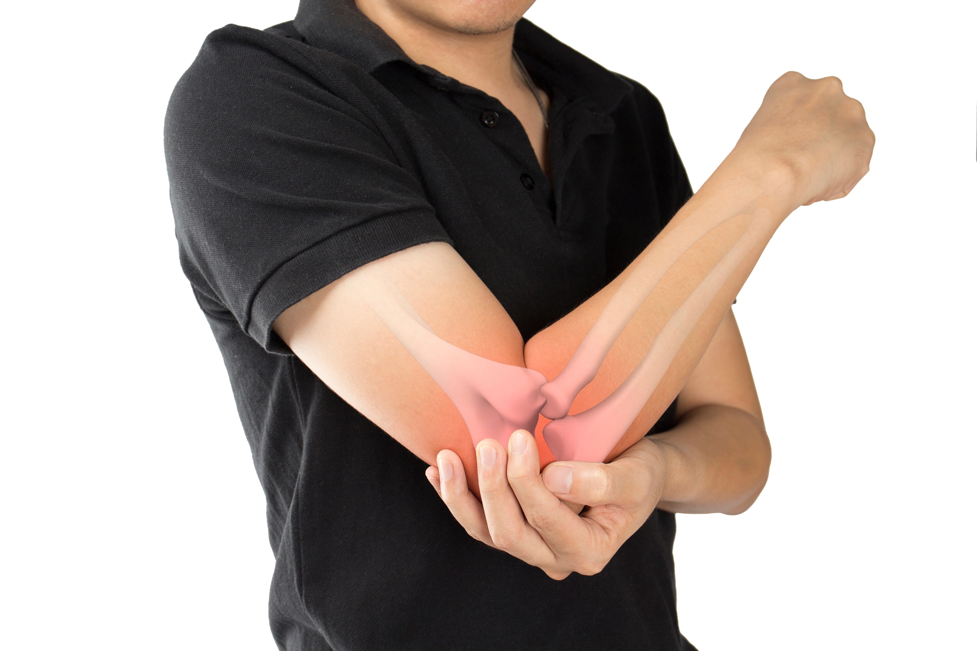 A graphic showing a man with an elbow injury and the bone beneath