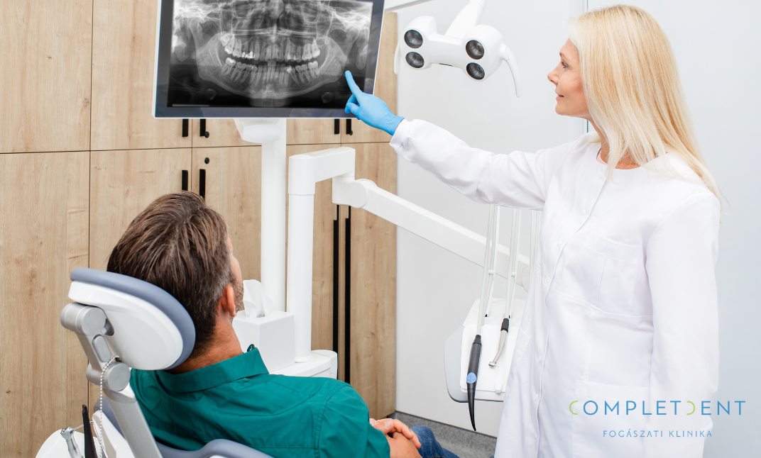 A konzultációt követően a fogorvos röntgenvizsgálatot végezhet. 