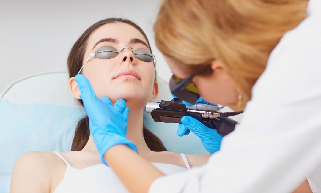 microneedling and laser