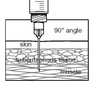 testosterone propionate injection method