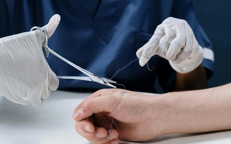 PLA biodegradable medical implants and absorbable sutures for medical applications