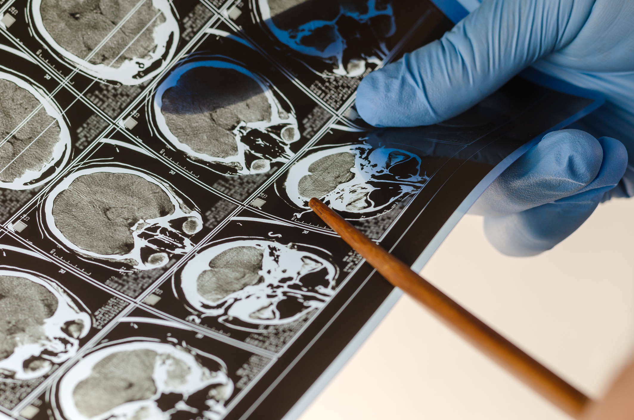 de los de los de los de los