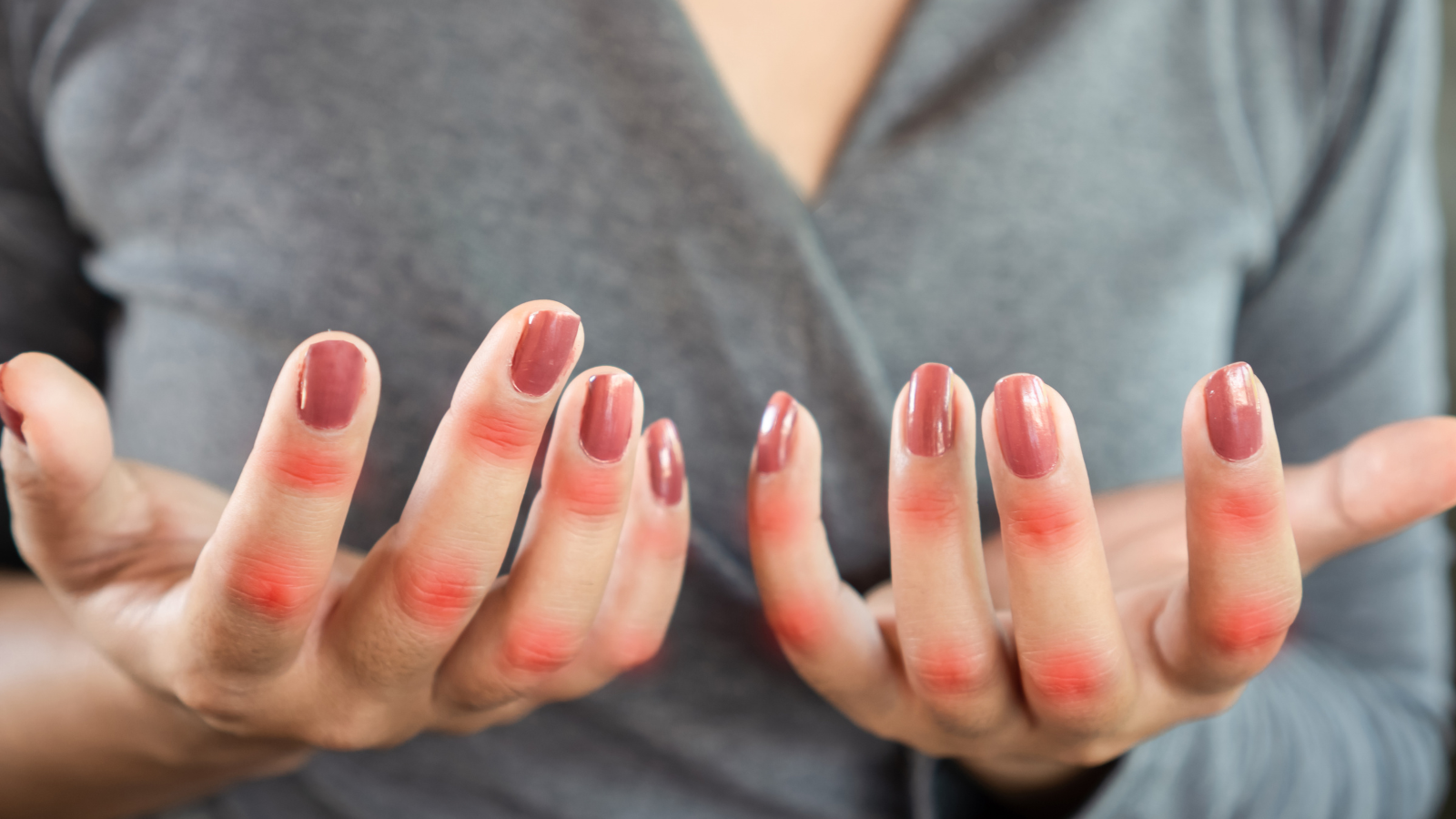 Gelenkschmerzen bei Frauen in den Wechseljahren durch Kollagenverlust