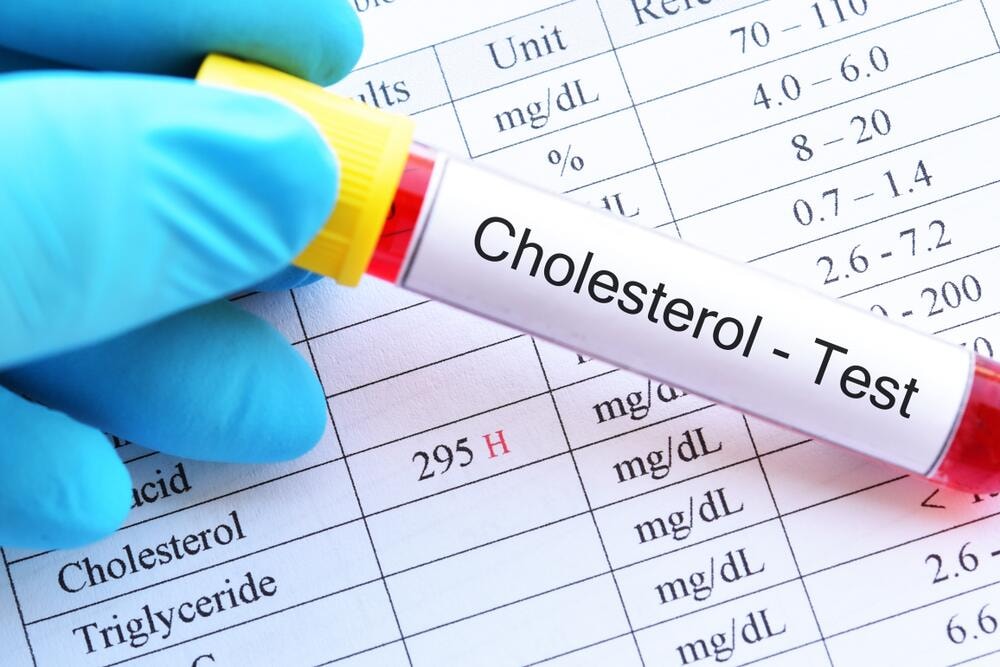 Understanding Cholesterol Tests and What Your Numbers Really Mean