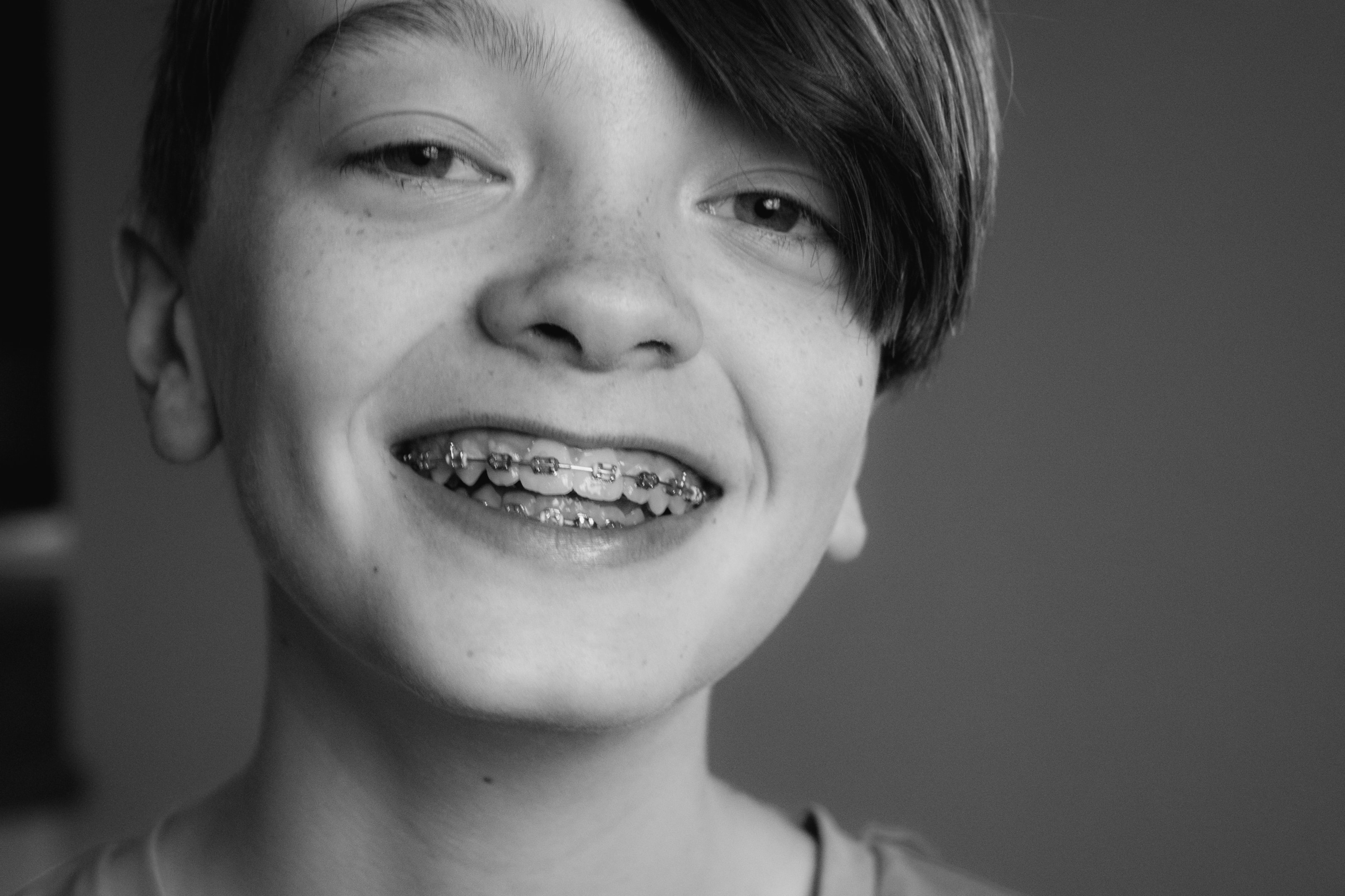 braces