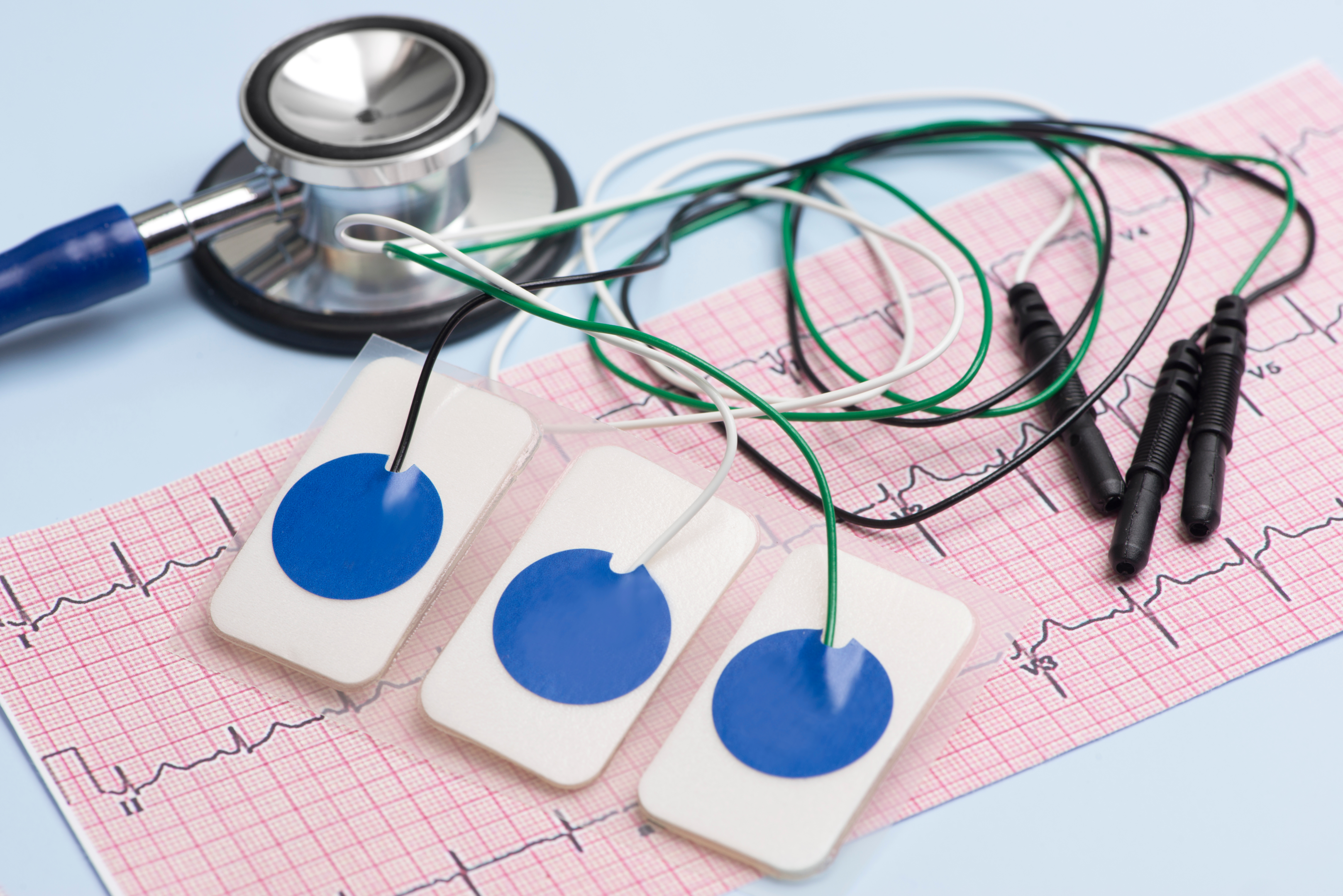 Electrocardiogram for monitoring cardiac health