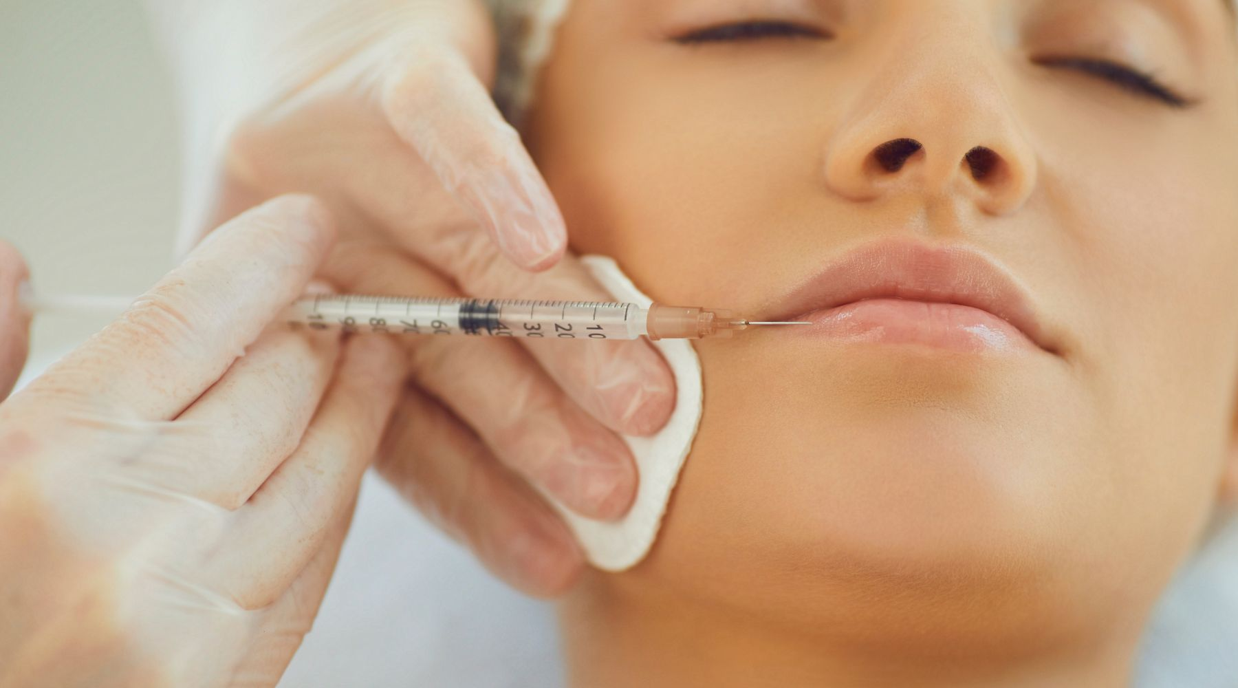 Medical professional administering a lip filler injection to a relaxed female patient in a clinical setting.