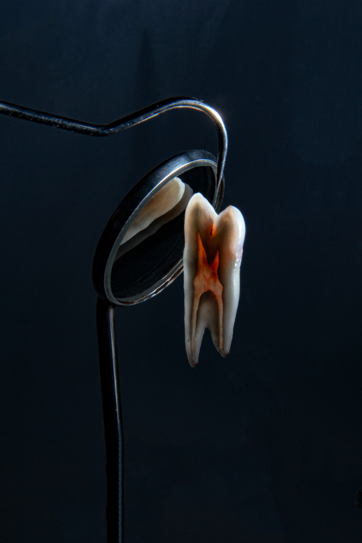 An illustration explaining the root canal treatment process.