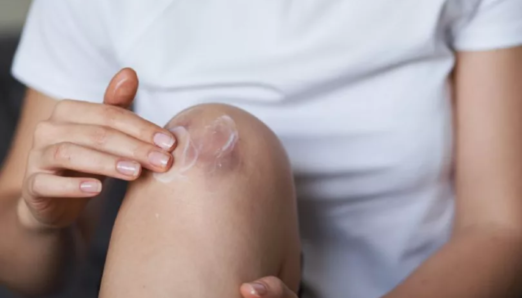 Person smører medisinsk krem på et mindre sår på kneet i et hjemlig miljø.