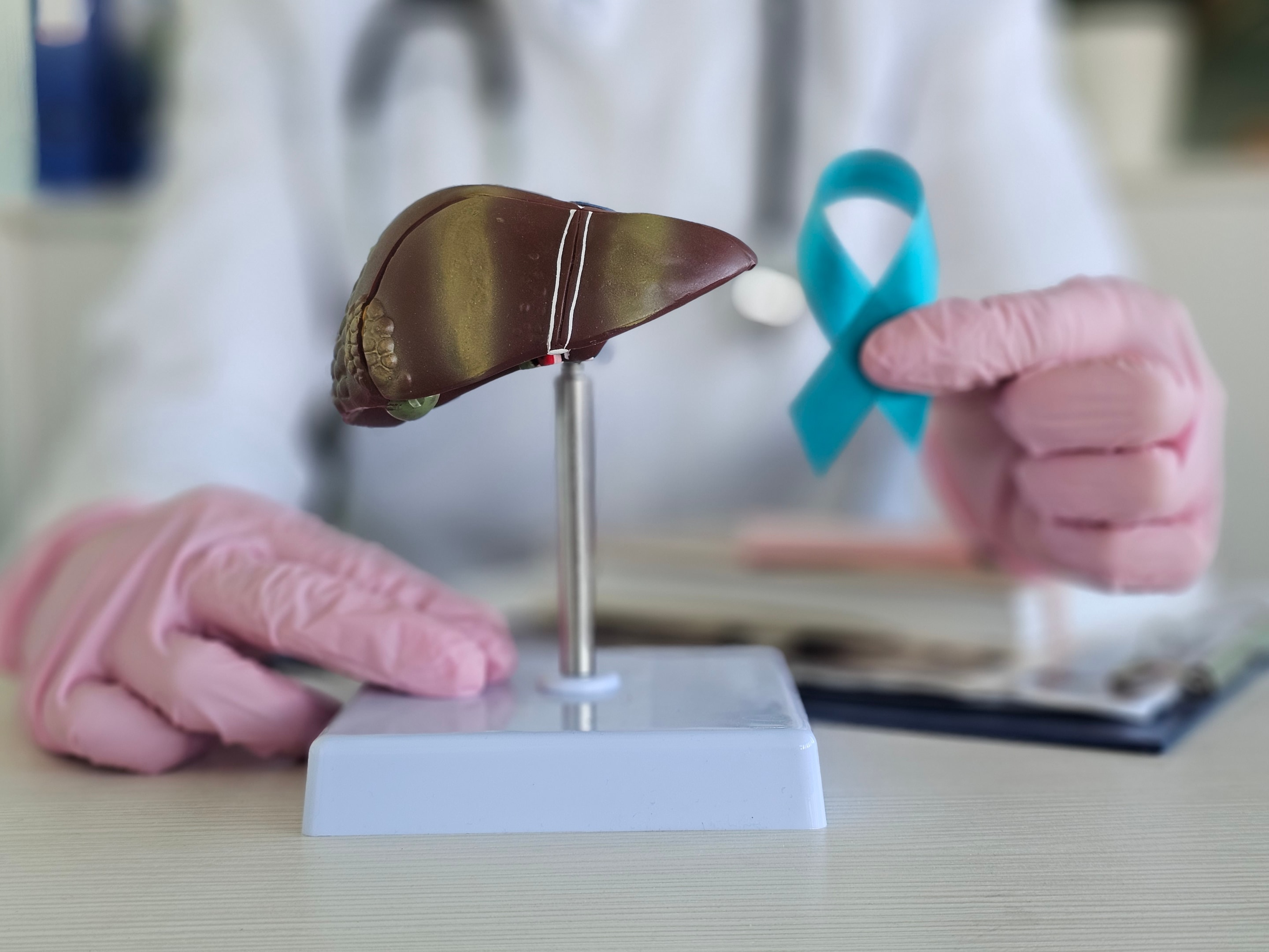 primary liver cancer