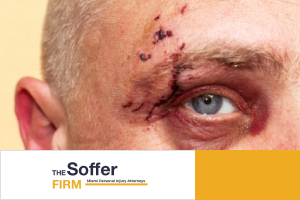 face-injuries-motorcycle-accident