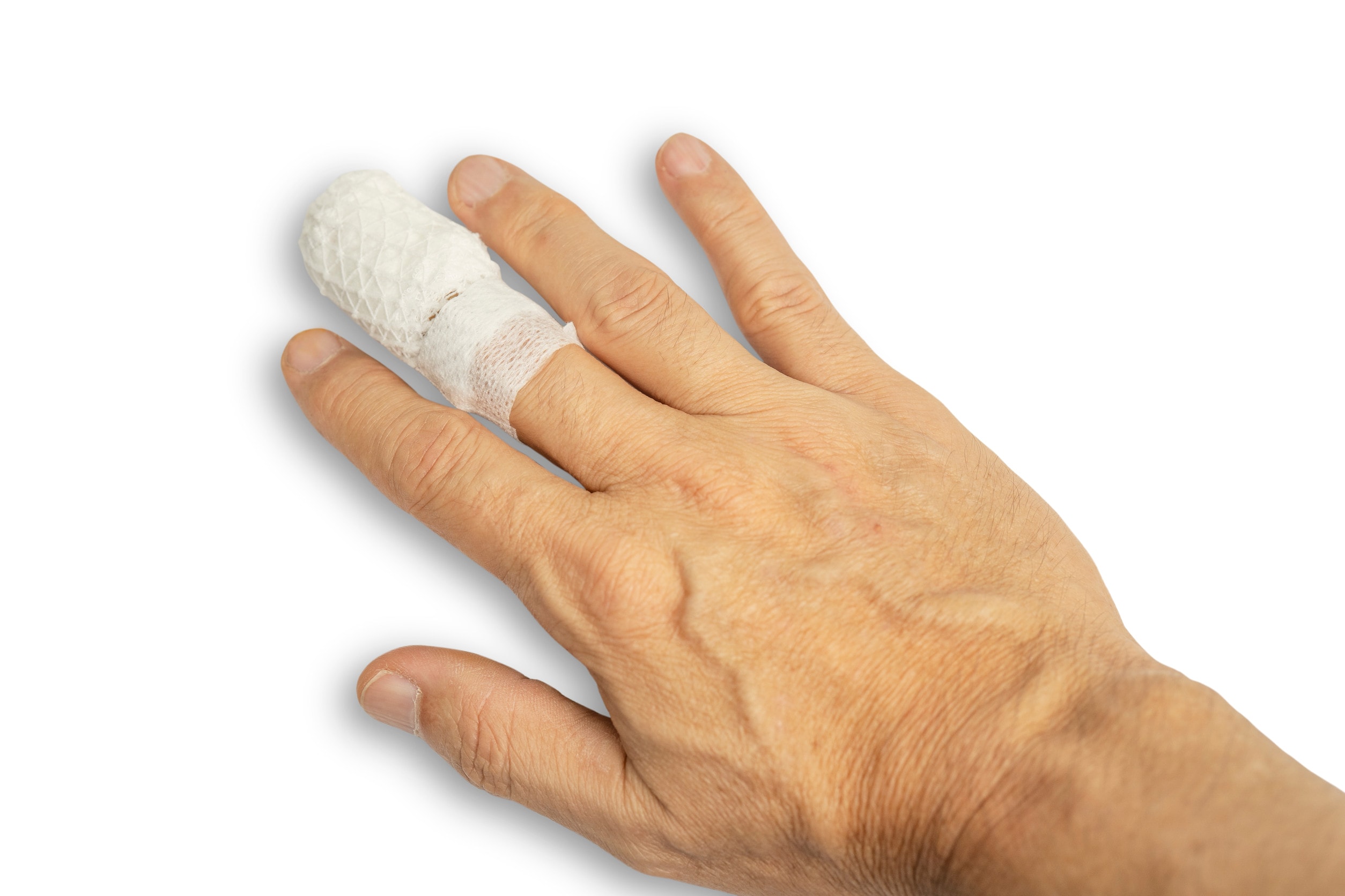 An injured person with a bandaged middle finger after suffering crushing injuries