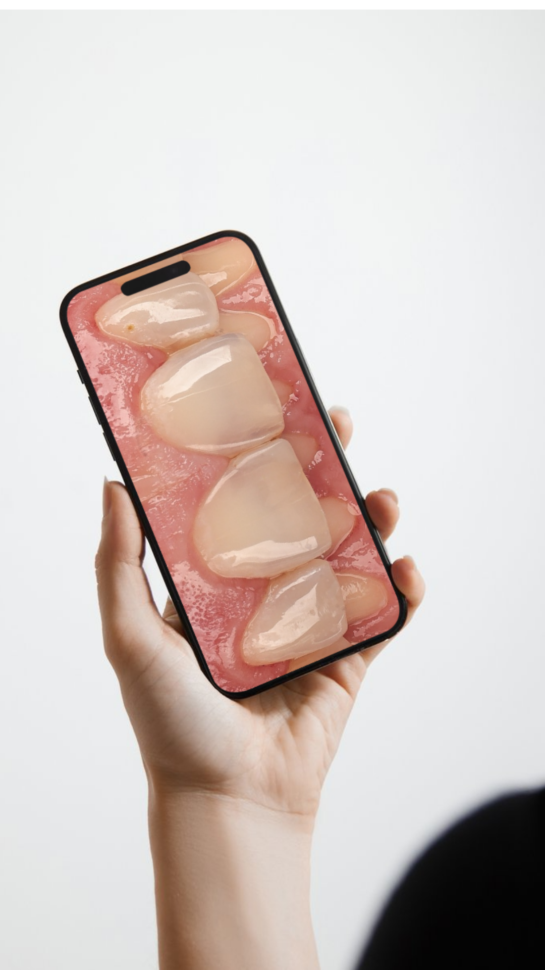 Dentalfotografie mit einem Smartphone zur Dokumentation von Patientenfällen.