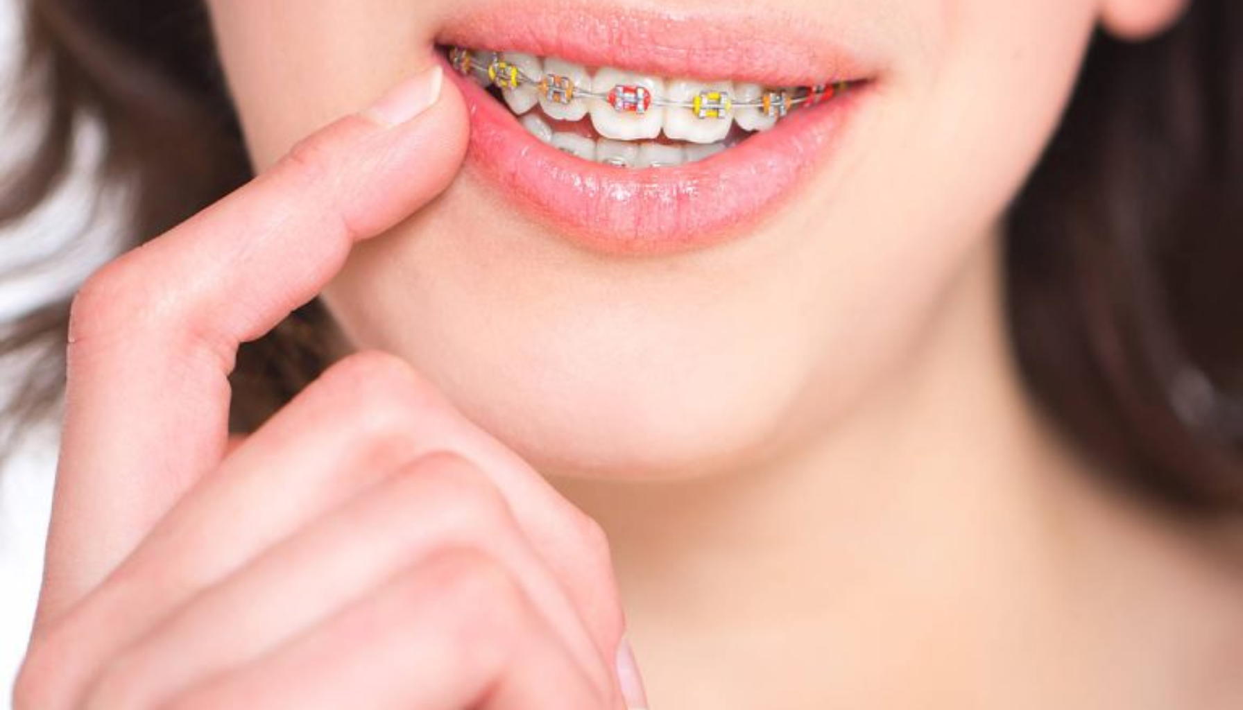 Nærbilde av jente som smiler med fargerik tannregulering og peker forsiktig på munnen sin.