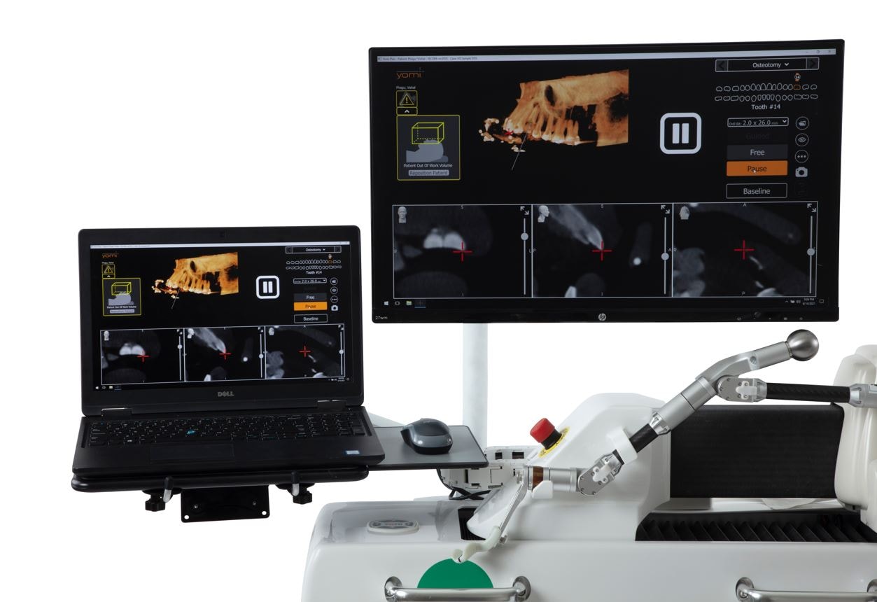 A close-up of a dental implant being placed with the assistance of robotic technology.