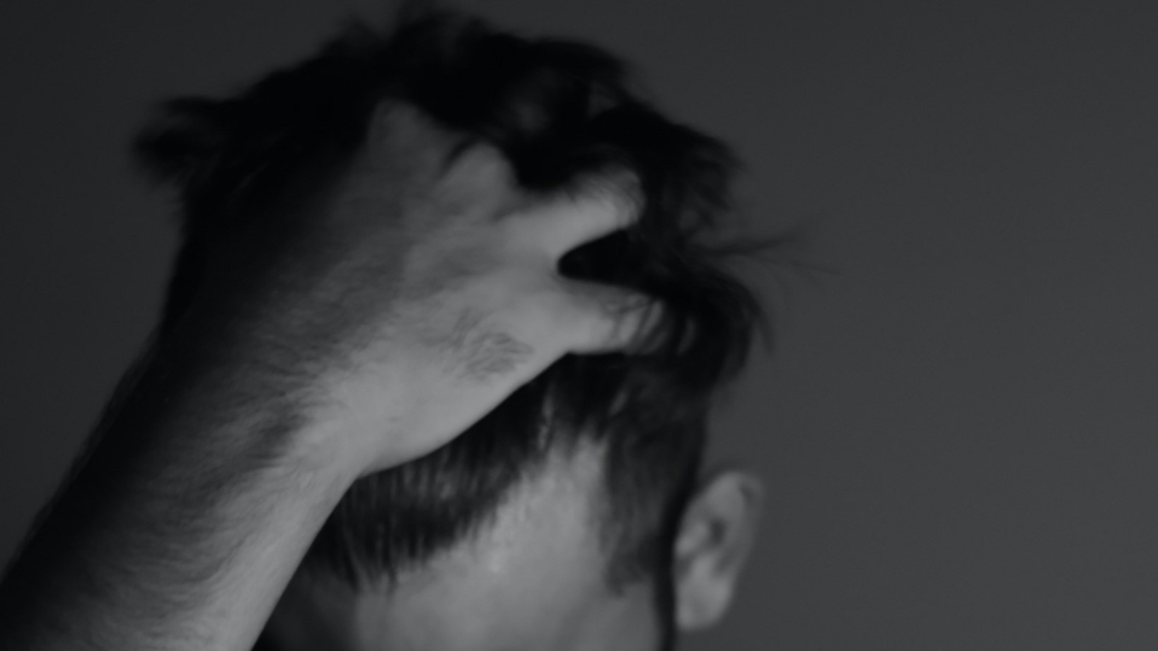 Männer Haare Shedding durch Wirkstoff Minoxidil